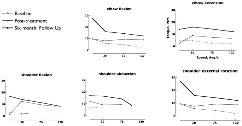 Strengthening Hemiparetic Patients with Biodex Multi-Joint System