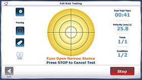 Fall Risk Screening Test